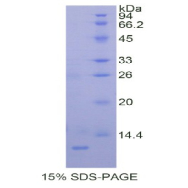 乳腺癌抗雌激素药物耐药性基因1(BCAR1)重组蛋白