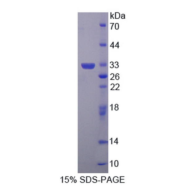 细胞因子诱导含SH2蛋白(CISH)重组蛋白