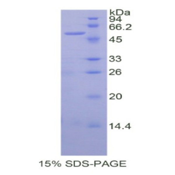 瘤变抑制因子14(ST14)重组蛋白