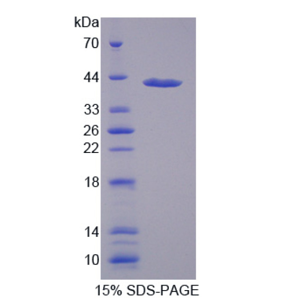 突触蛋白Ⅰ(SYN1)重组蛋白