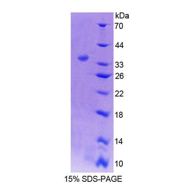 纺锤体蛋白3(SPIN3)重组蛋白