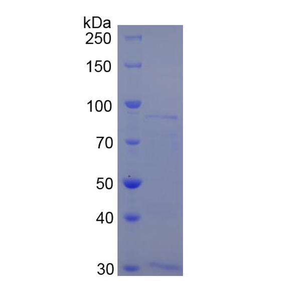 血小板反应蛋白解整合素金属肽酶7(ADAMTS7)重组蛋白