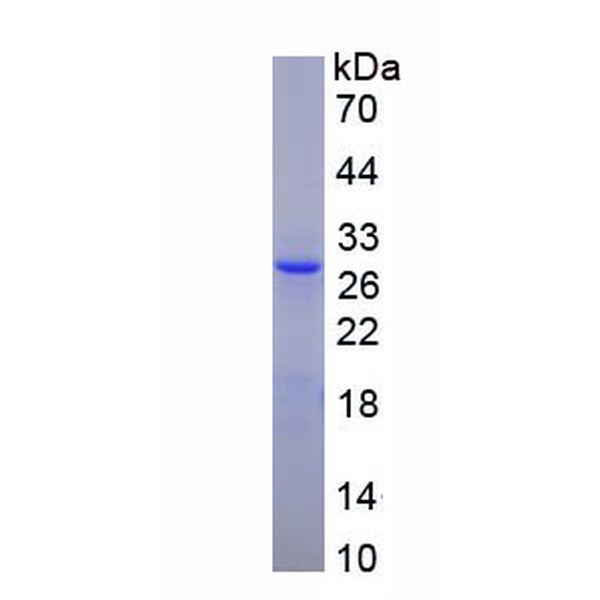 CD320分子(CD320)重组蛋白