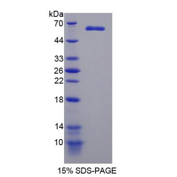外异蛋白A(EDA)重组蛋白