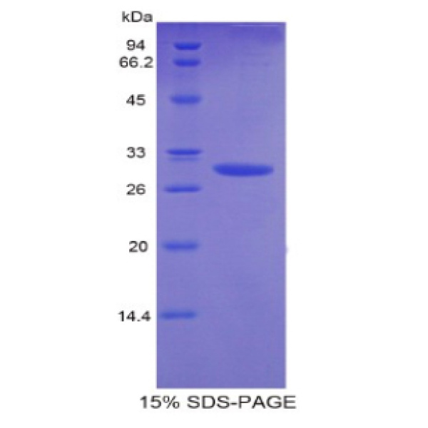 侧支发芽因子同源物3(SPRY3)重组蛋白