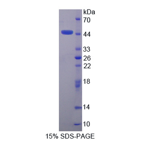 序列相似家族5成员C(FAM5C)重组蛋白