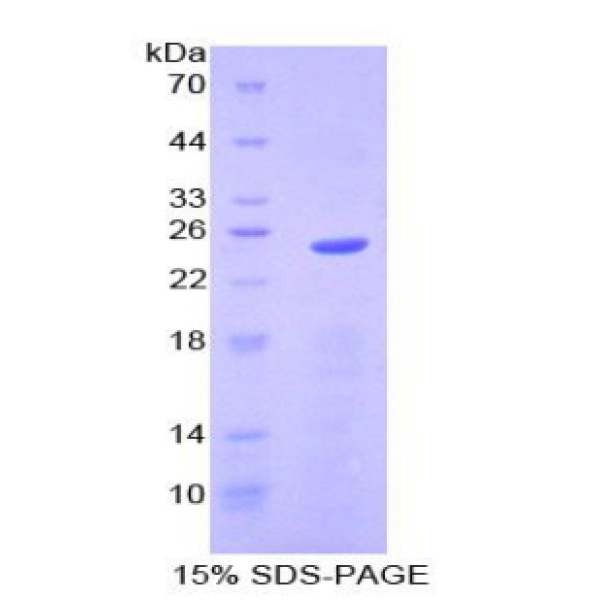SPRY2重组蛋白；侧支发芽因子同源物2重组蛋白