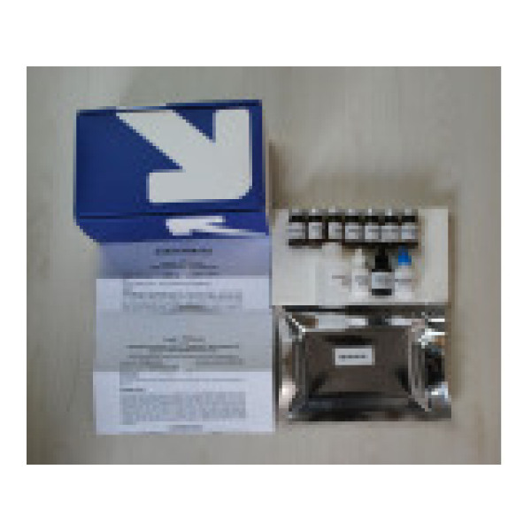 人血管紧张素Ⅴ(Ang-Ⅴ)ELISA试剂盒