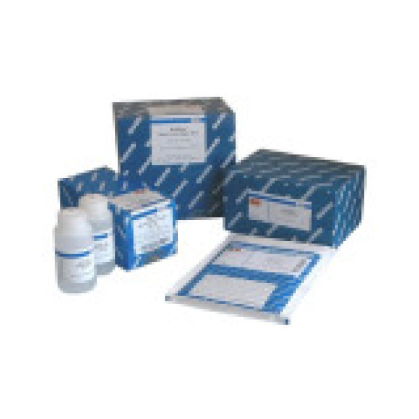 人丝氨酸脱水酶(SDS)ELISA试剂盒