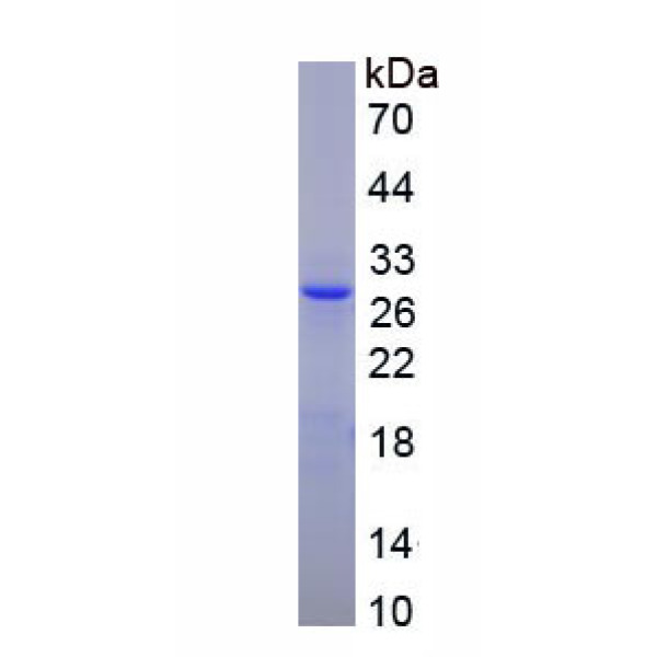 无翅型MMTV整合位点家族成员10B(WNT10B)重组蛋白