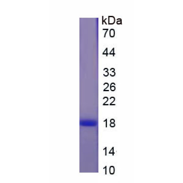 CD59重组蛋白；保护素重组蛋白