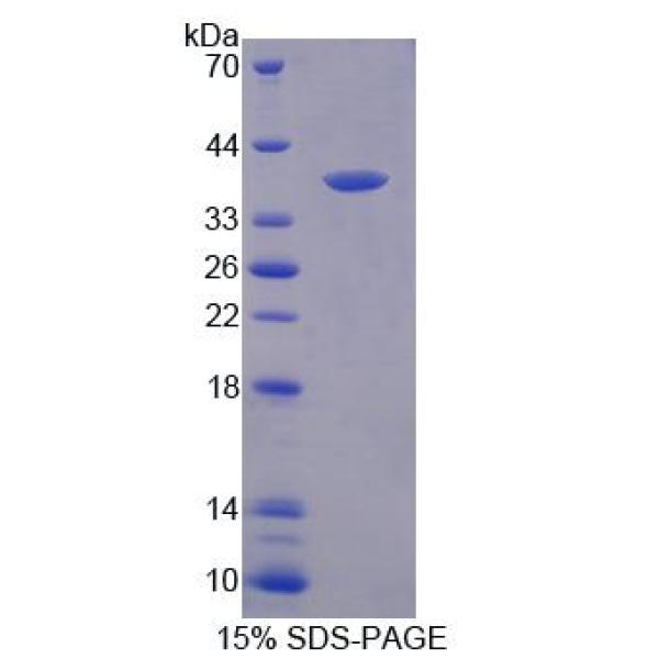 85kDa核孔蛋白(NUP85)重组蛋白