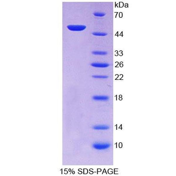 T-细胞免疫调节因子1(TCIRG1)重组蛋白