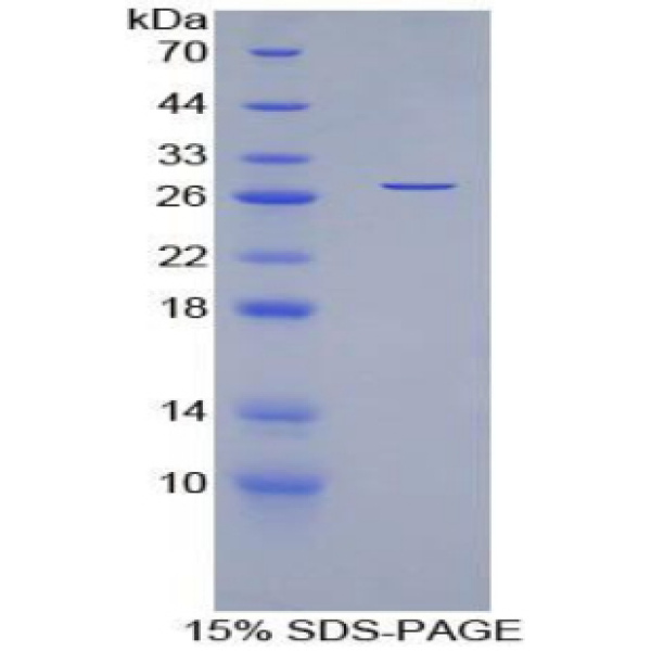 含SCAN域蛋白3(SCAND3)重组蛋白