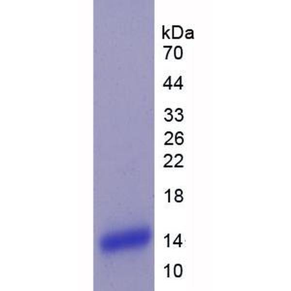 溶质载体家族39成员6(SLC39A6)重组蛋白