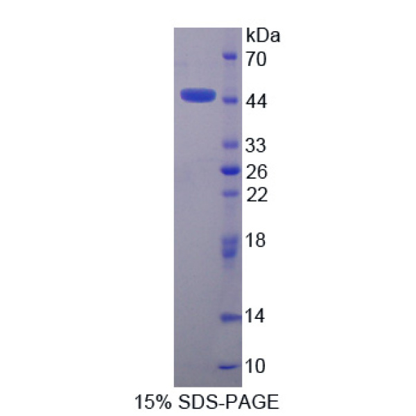 肾损伤分子1(Kim1)重组蛋白