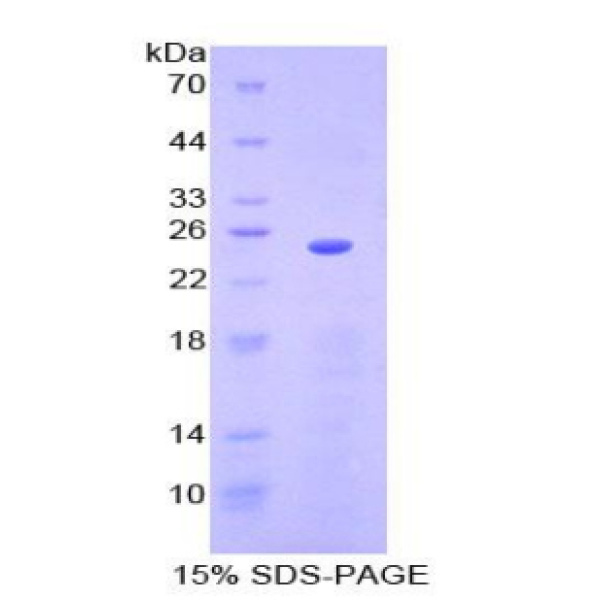 SPRY3重组蛋白；侧支发芽因子同源物3重组蛋白