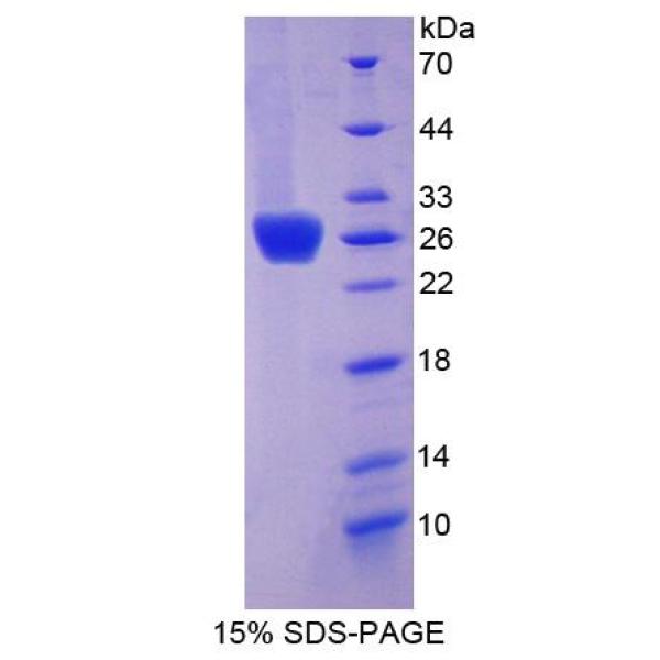 CXADR重组蛋白；柯萨奇病毒腺病毒受体重组蛋白