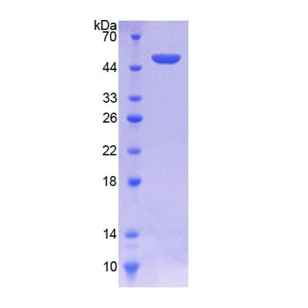 脯氨酸/丝氨酸丰富卷曲螺旋蛋白1(PSRC1)重组蛋白