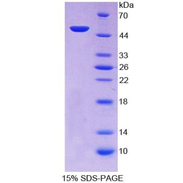 皮屑蛋白样蛋白1(LEPREL1)重组蛋白