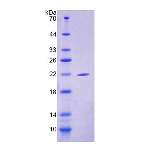 钙非依赖性磷脂酶A2(iPLA2)重组蛋白