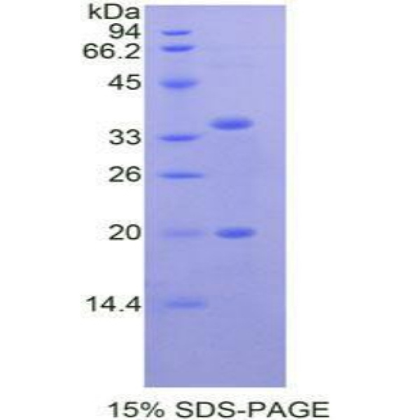 DNA损伤诱导转录因子3(DDIT3)重组蛋白