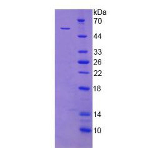 XRCC5重组蛋白；X-射线修复交叉互补蛋白5重组蛋白