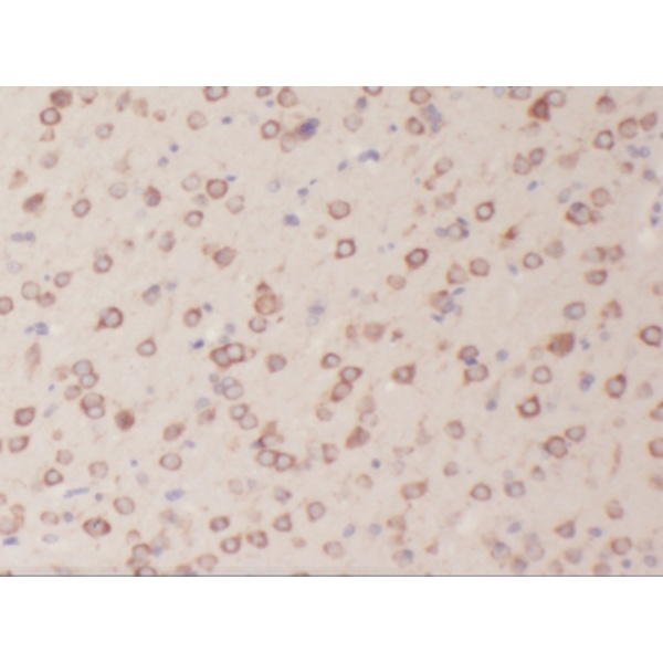 anti- ABI2 antibody