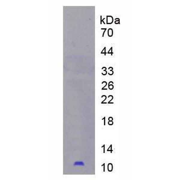 PI3重组蛋白；皮肤衍生肽酶抑制因子3重组蛋白