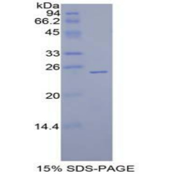 SPRY1重组蛋白；侧支发芽因子同源物1重组蛋白