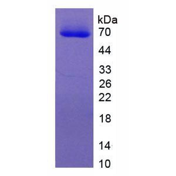 含三联基元蛋白3(TRIM3)重组蛋白