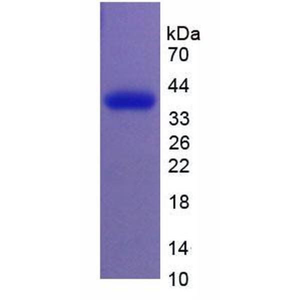 同种异体移植炎症因子1(AIF1)重组蛋白