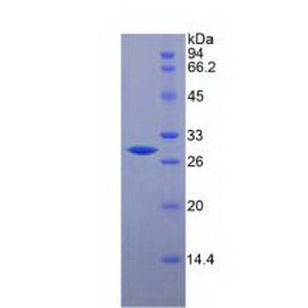 CHI3L1重组蛋白；C重组蛋白