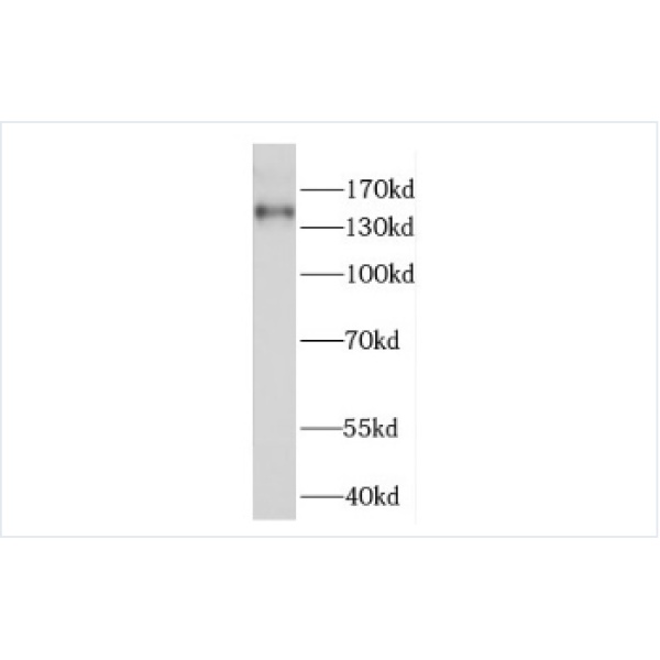 anti- FANCI antibody