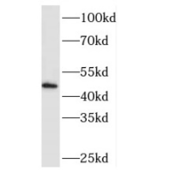 anti- MEIS3 antibody