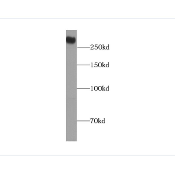 anti- Desmoplakin antibody