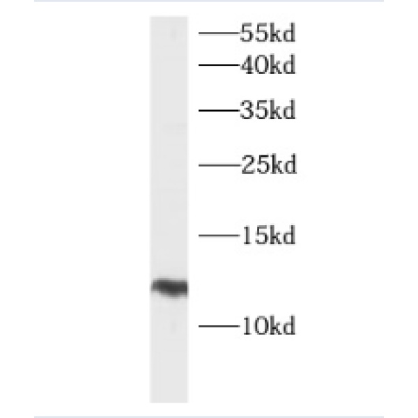 anti- HBXIP antibody