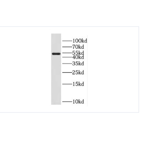 anti- FAM124B antibody