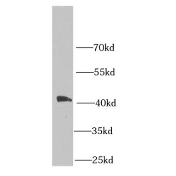 anti- MPI antibody