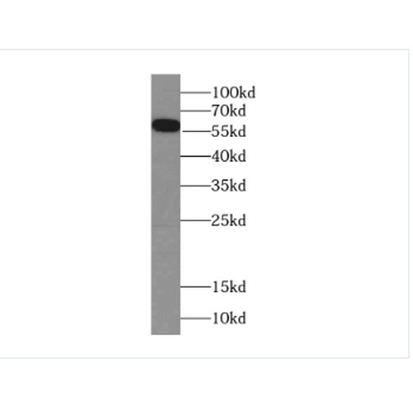 anti- domain-I-of-FIZ-1 antibody