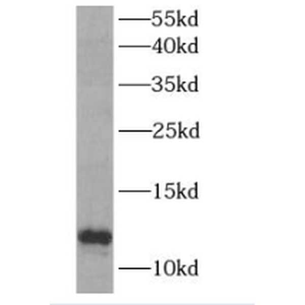 anti- MIF antibody