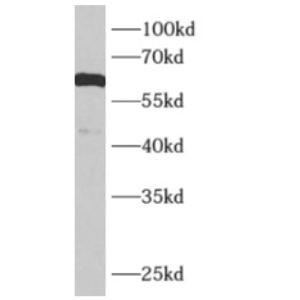 anti- KCNJ3 antibody