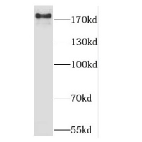 anti- JMJD3 antibody