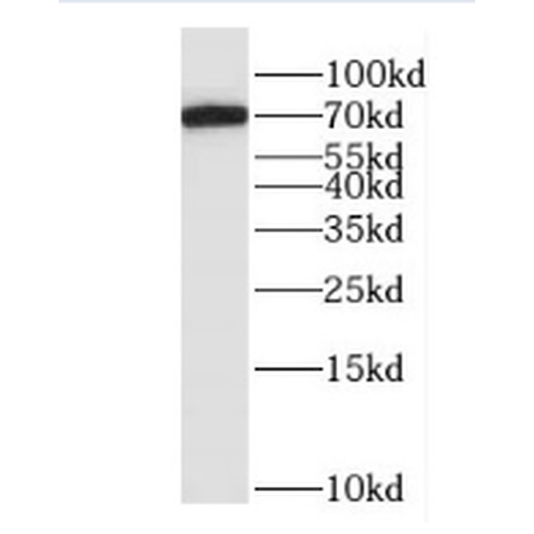 anti- Hemopexin antibody