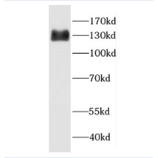 anti- GMIP antibody