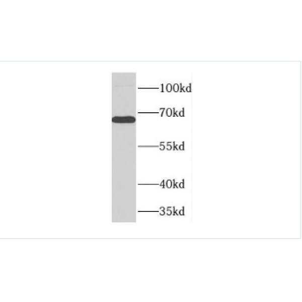 anti- FARSB antibody