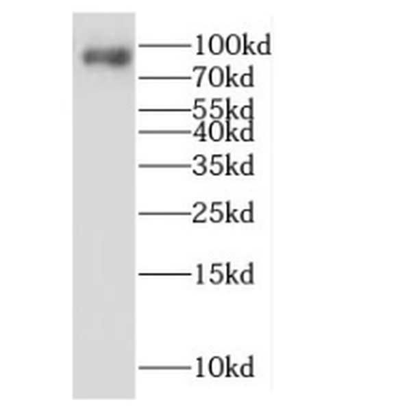 anti- LENG8 antibody