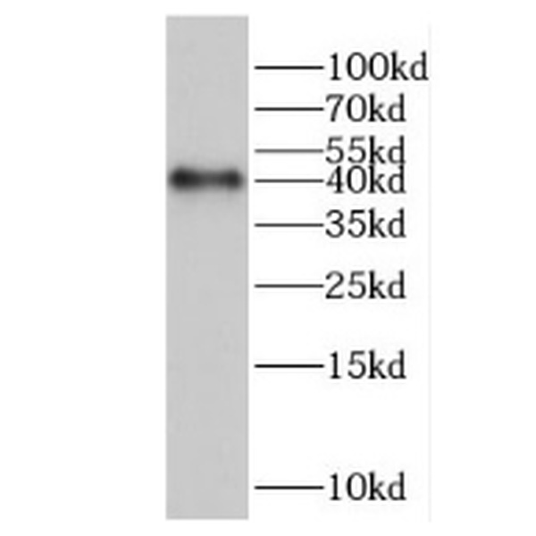 anti- HERPUD2 antibody