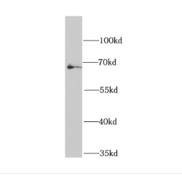 anti- BCHE antibody