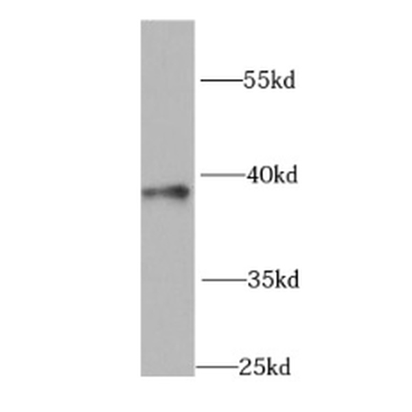 anti- GNAO1 antibody